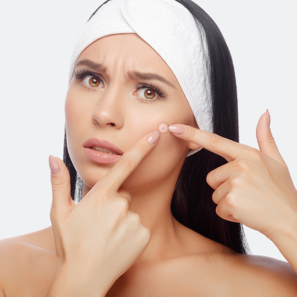 Skin Pro+ Patches